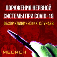 Поражения нервной системы при COVID-19